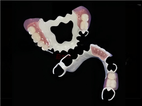 Peek  Framewrok  with  teeth